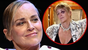 sharon stone black eye