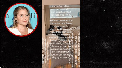 120225_amy_schumer_kal