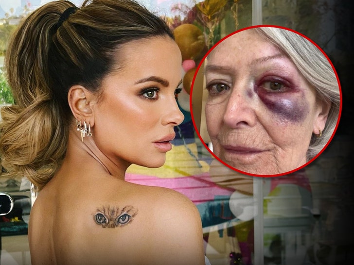 Kate Beckinsale and her mom injury