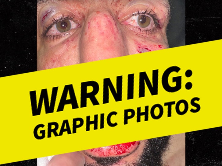 Belal Muhammad's injury