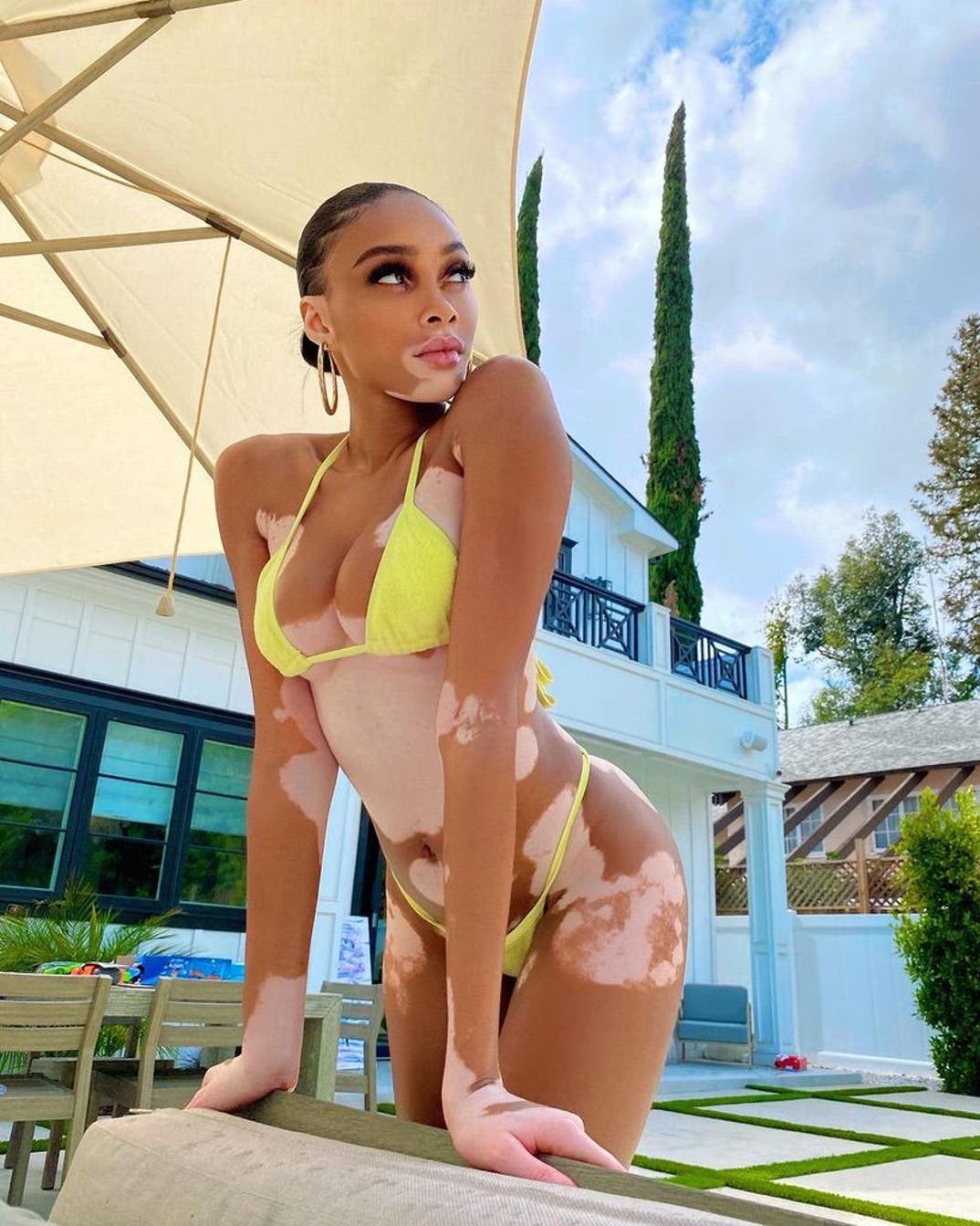 Winnie Harlow
