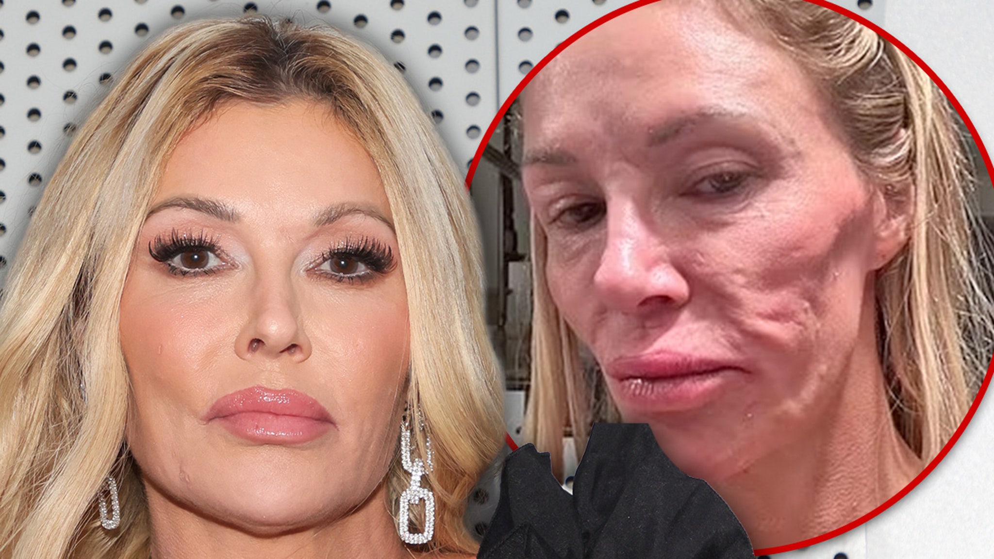 Brandi Glanville Gives Depressing Update on Facial Condition