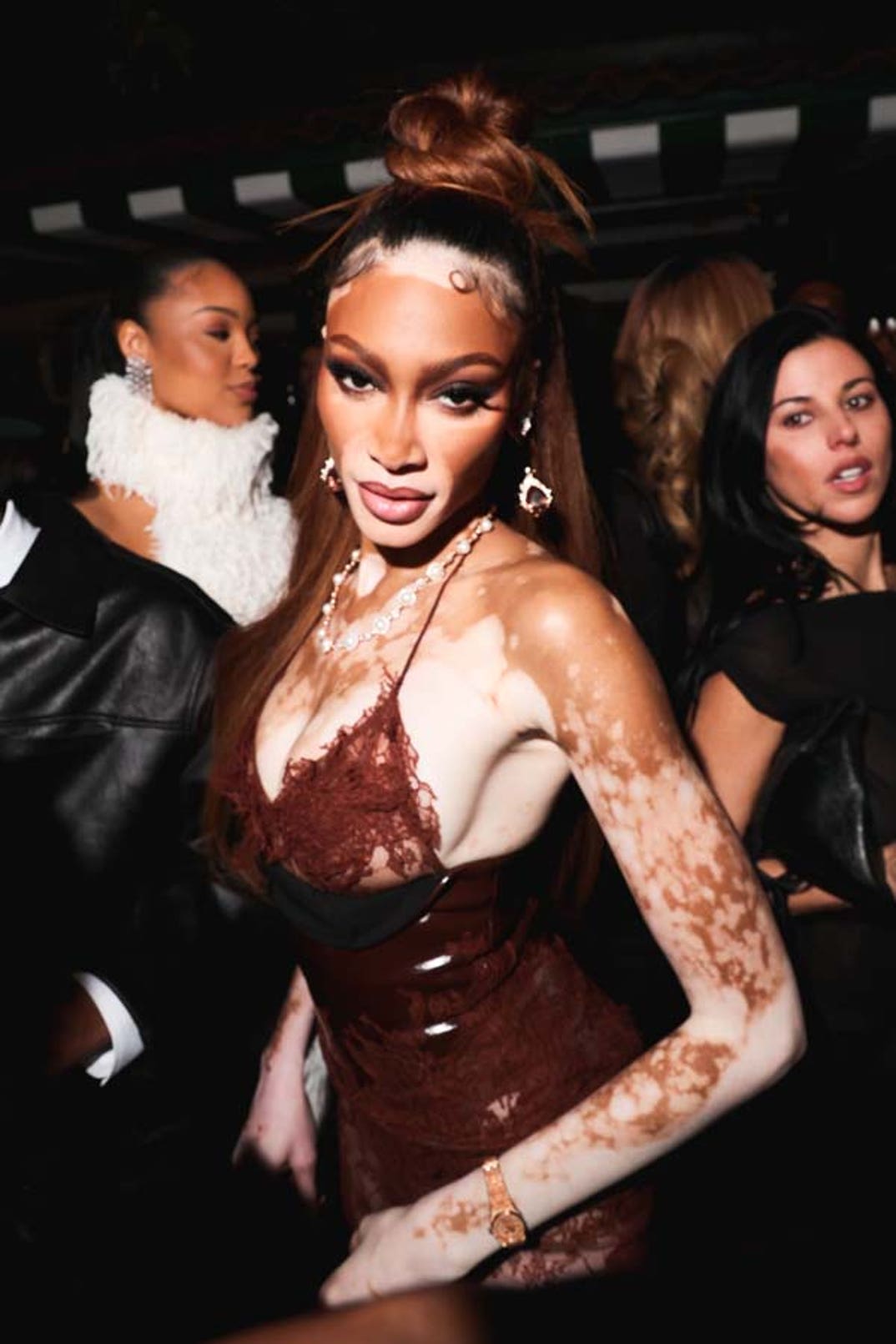 winnie harlow shutterstock_editorial_16499880bd