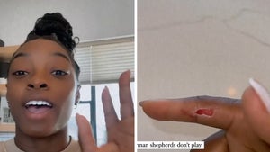 Simone Biles Suffers Gnarly Finger Wound After German Shepherd Attack