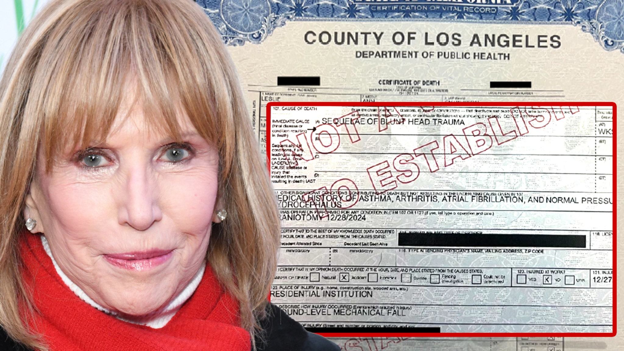 ‘General Hospital’ Star Leslie Charleson’s Cause of Death Revealed