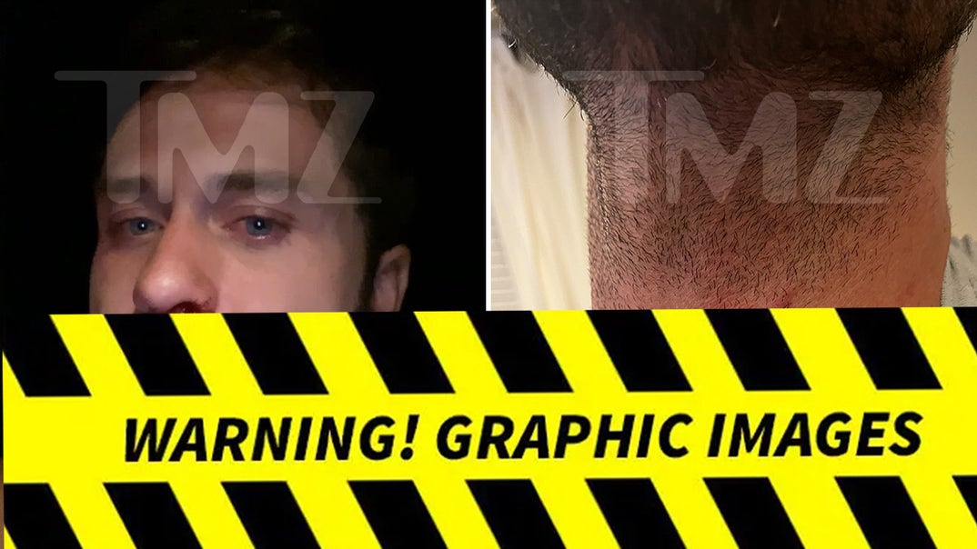 0416-Dakota-Mortensen-Alleged-Injuries-PRIMARY