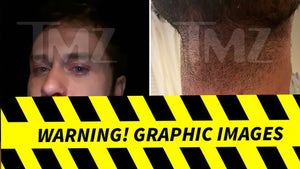 0416-Dakota-Mortensen-Alleged-Injuries-PRIMARY