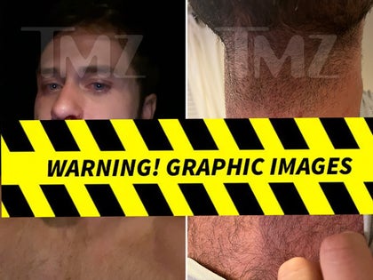 0416-Dakota-Mortensen-Alleged-Injuries-PRIMARY