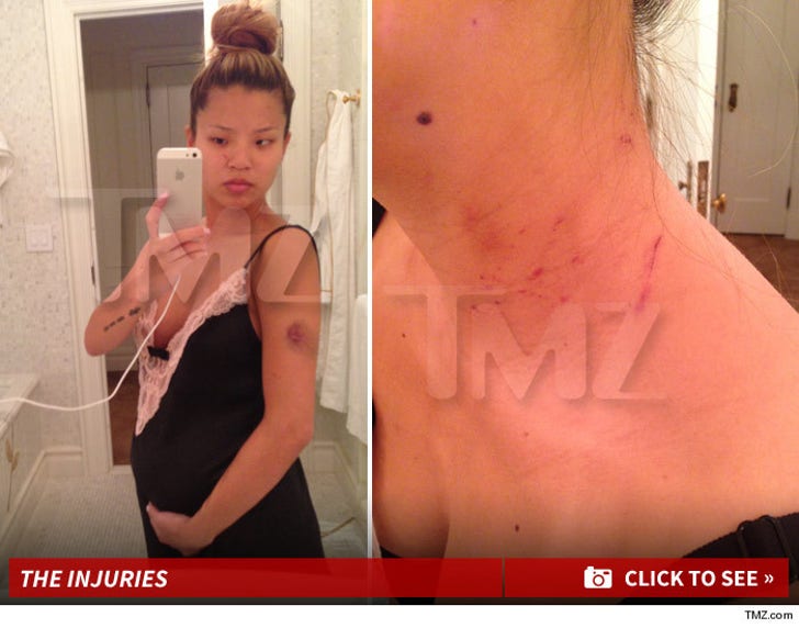The-Dream -- Baby Mama Photographed Injuries After Alleged Attack