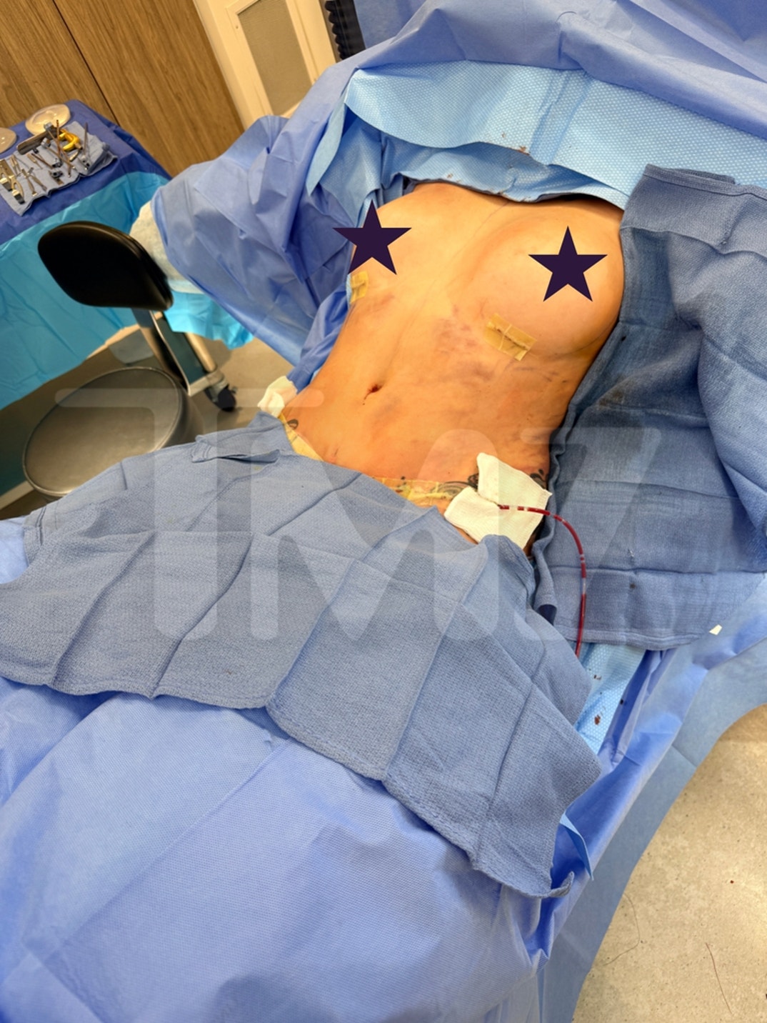 Janelle Evans Mommy Makeover AFTER 4