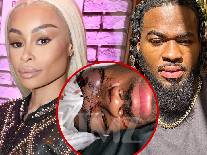 Blac Chyna Sued by Ex-Boyfriend Claiming She Beat Him Up In His Sleep