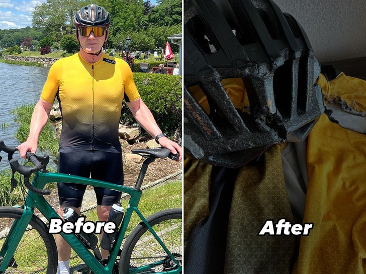 before after gordon ramsay bike accident