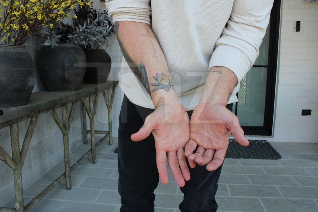 Alan Ritchson Injury Photos 1