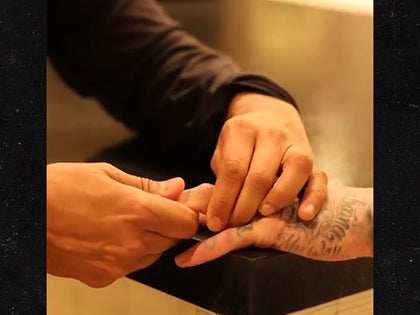 Travis Barker hand injury