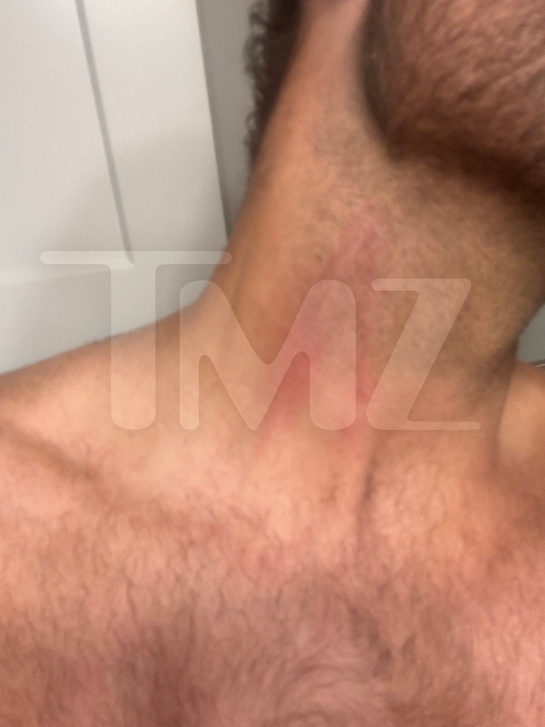 Dakota Mortensen Alleged Injuries 4