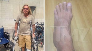 Vince Neil -- The Show Must Go On ... Even With My Broken Foot!
