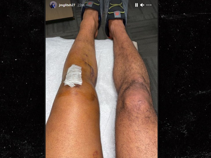 NBACentral on X: Jamal Murray has a floor burn on his hand