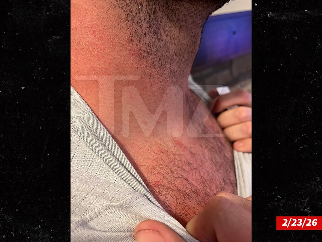 Dakota-Mortensen-Alleged-Injuries-Swipe- 1