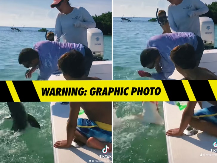 Shark Bites Man's Pinky Off