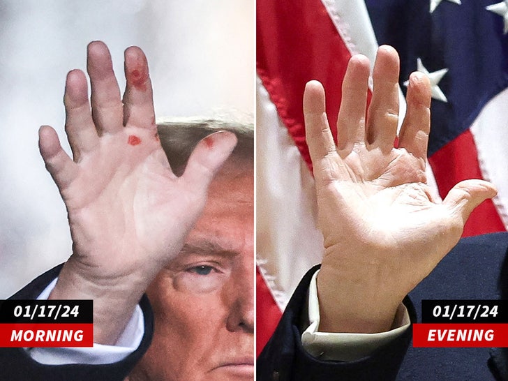 trump hand split