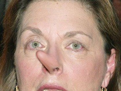 0701_liz_r_nose_01
