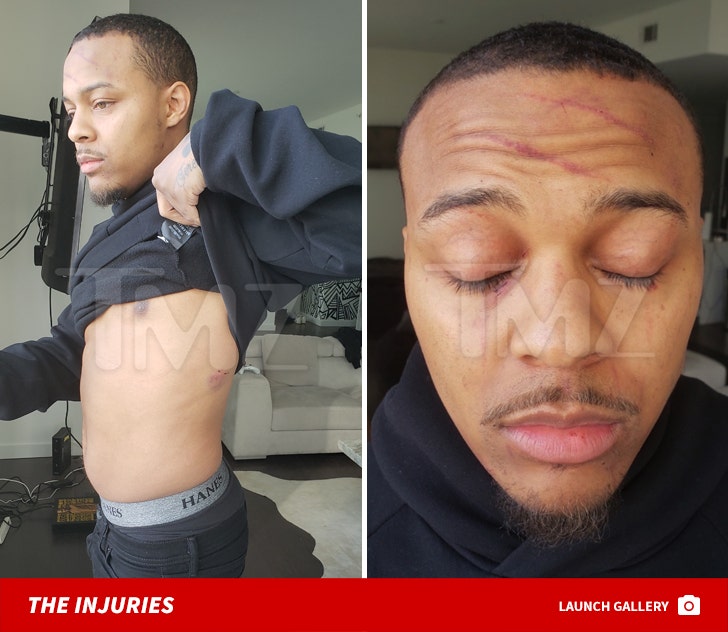 Bow Wow Injuries