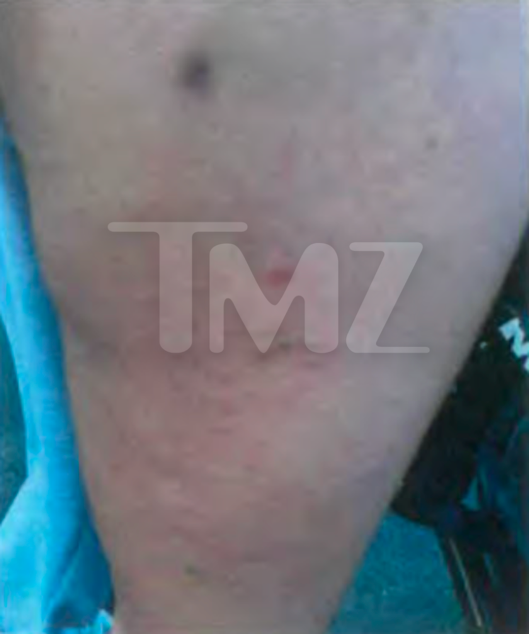 Maria Lafuente Injuries 1