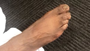 NBA's Reggie Jackson Reveals Jacked Up Feet!