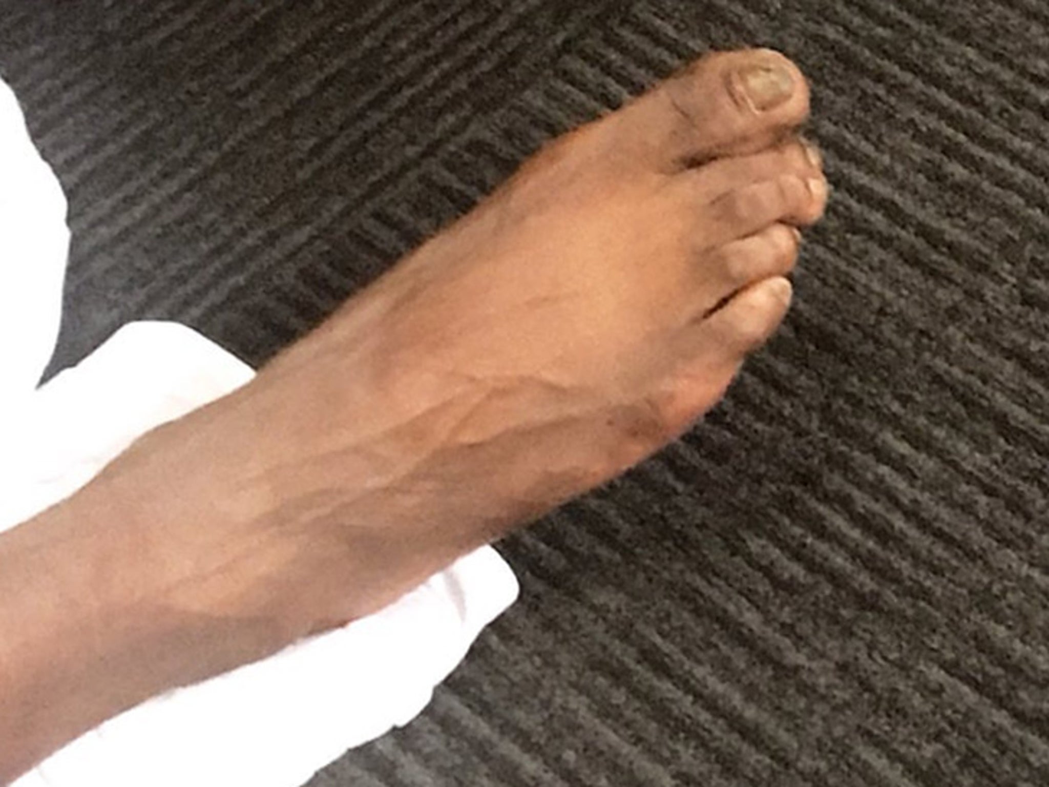 Why do guys have ugly feet