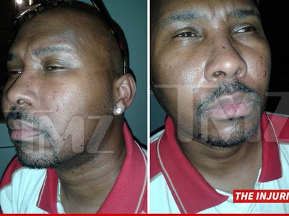 0703-kat-williams-injuries-main-tmz-01