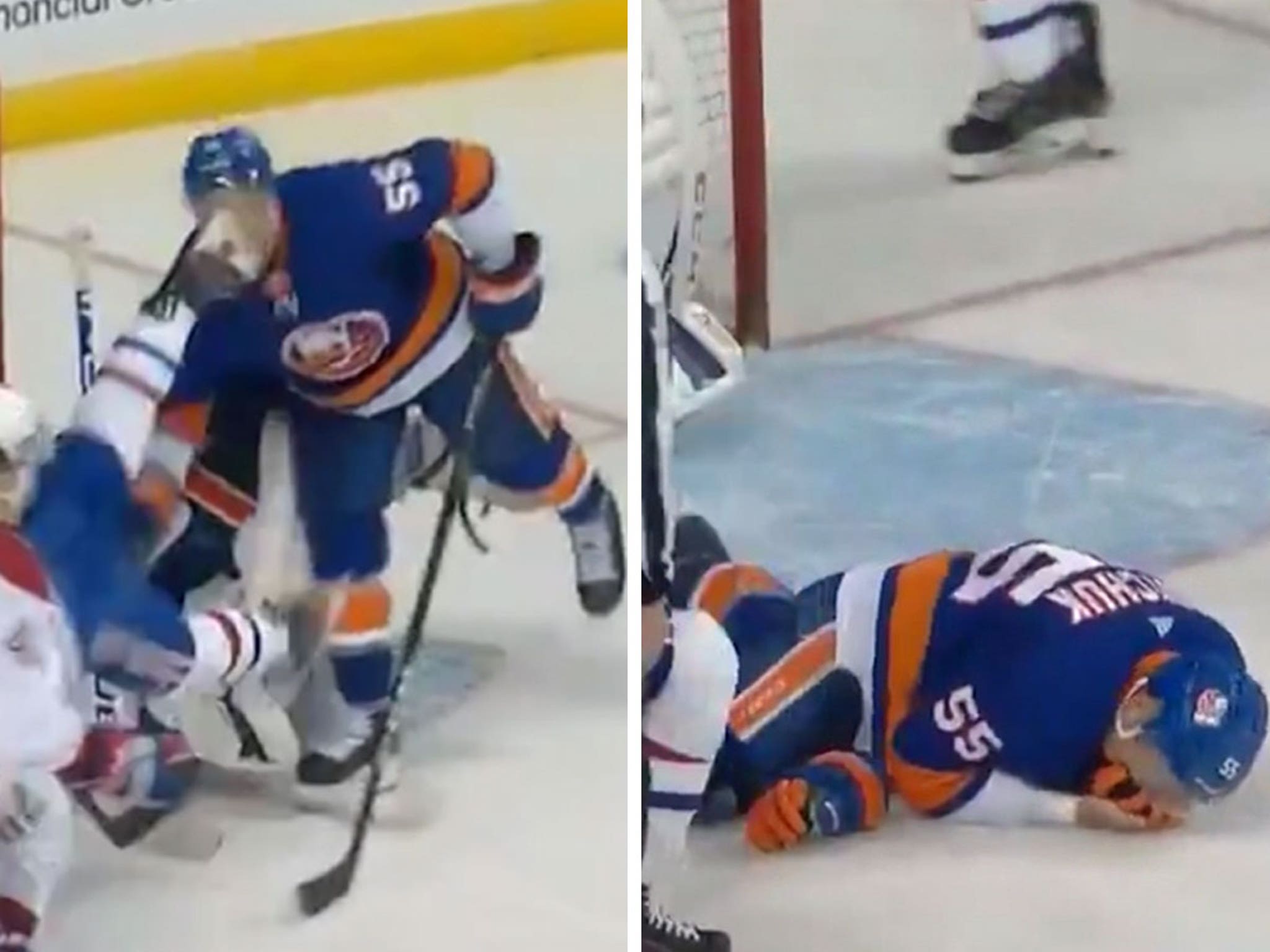 Johnny Boychuk from Edmonton Took A Brutal Skate To The Face At