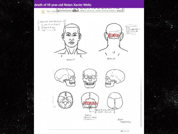 nolan wells alleged injuries to head handout 1