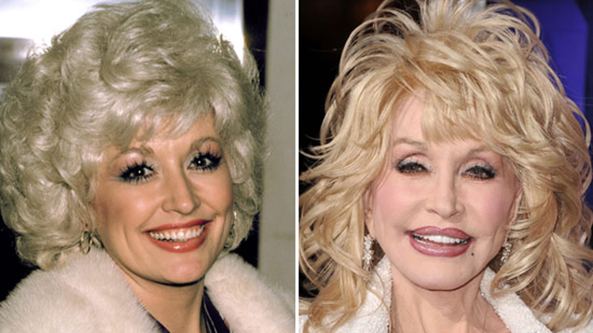 Dolly parton before plastic surgery
