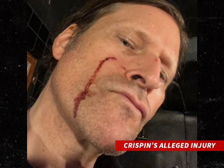 sub-Crispin-glover-injury-2