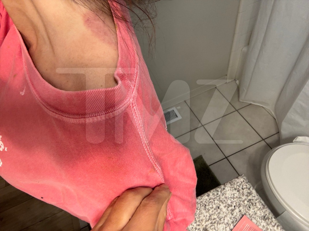 Taylor Frankie Paul Alleged Injuries  3