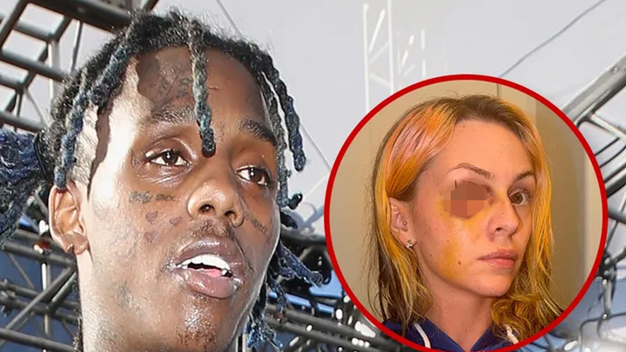 Famous Dex Allegedly Gave Reality Star Ex a Black Eye, See Shocking Photos
