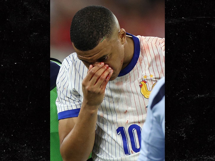 Kylian Mbappe injures nose