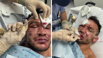 111021_michael_chandler_kal_1