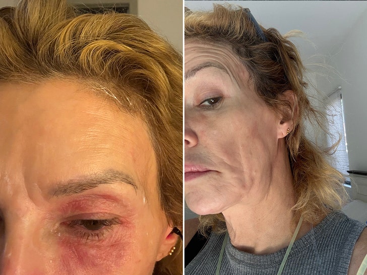 Brandi Glanville gofundme 2