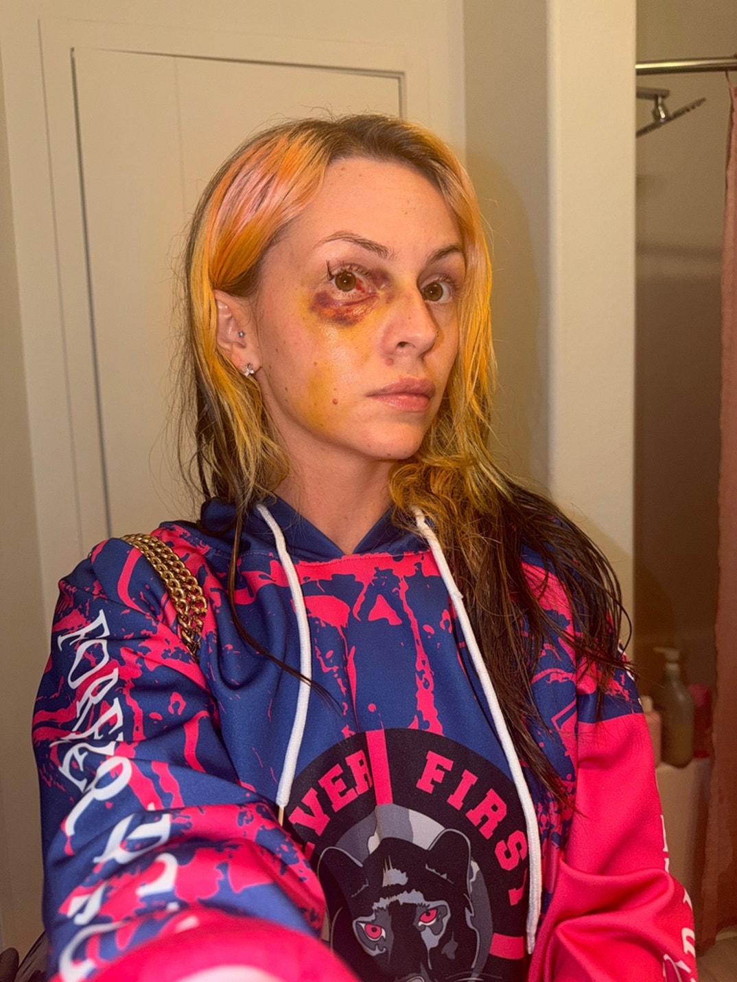 Pam Rodriguez Alleged Injury Photos 1