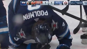 NHL's Tucker Poolman Takes Puck To Face, Leaves Huge Trail Of Blood On Ice