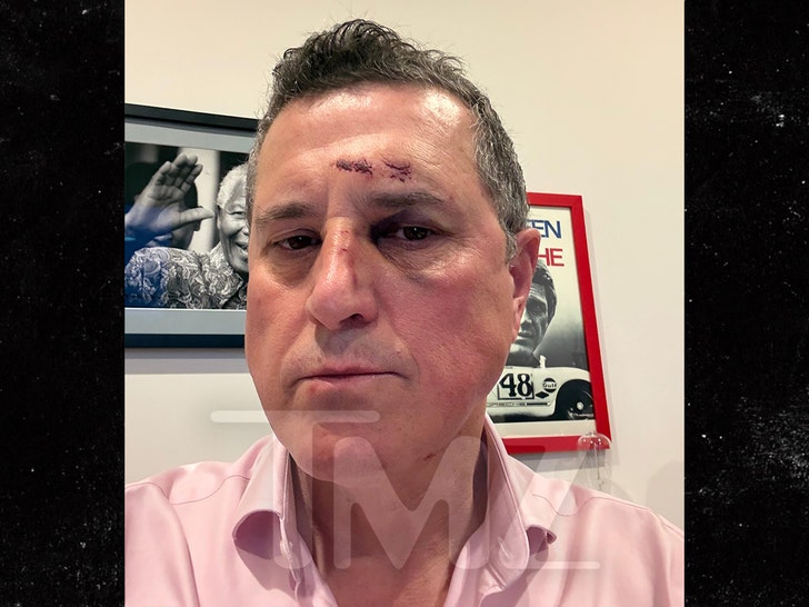 ronnie taylor lesões tmz folheto 2