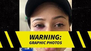 Rich the Kid's GF, Tori Brixx, Suffers Brutal Face Injury from Home Invasion Attack
