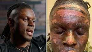 David Njoku's Doctor Says Browns Star Burned 17% Of Body In Bonfire Accident