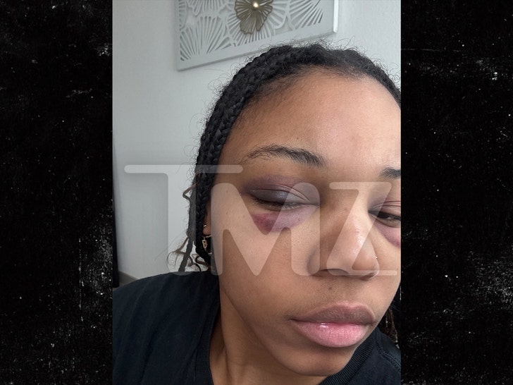 Eryn Bonner Injuries handout wm 1