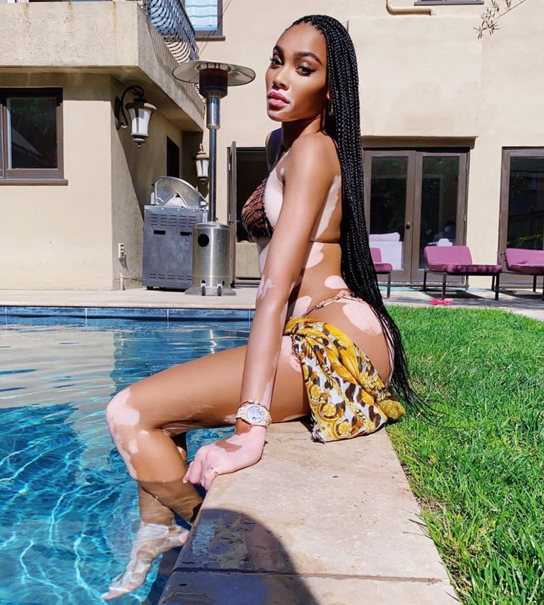 winnie harlow hot Shots 0