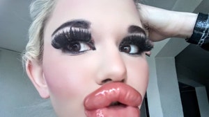 'Real-Life Barbie' Shows Off Giant Lips After 20th Filler Injection