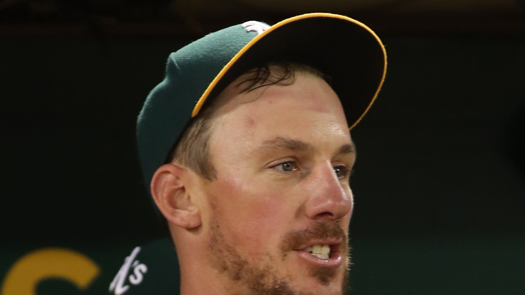 A's Star Chris Bassitt Gets Plate In Face During Successful Surgery