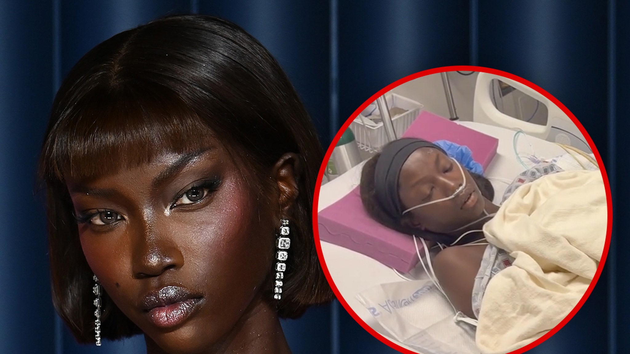 Supermodel Anok Yai gediagnosticeerd met een aangeboren longafwijking