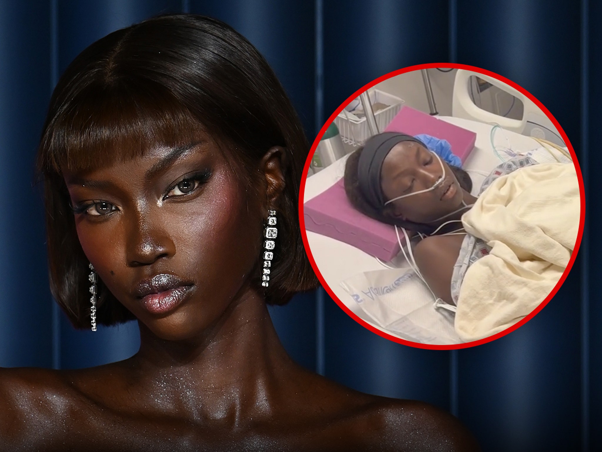 Supermodel Anok Yai Diagnosed with Congenital Lung Defect